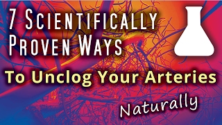 7 Scientifically Proven Ways To Unclog Your Arteries Naturally [upl. by Vashti]