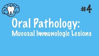 Oral Pathology  Mucosal Immunologic Diseases  INBDE ADAT [upl. by Aneeroc]