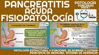 PANCREATITIS AGUDA FISIOPATOLOGÍA  GuiaMed [upl. by Edmond]