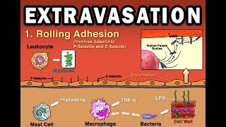 EXTRAVASATION [upl. by Eignat]