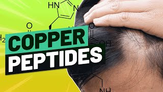 Copper Peptides for Hair  Does It Help Hair Grow [upl. by Akimaj894]