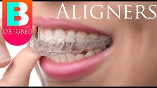 Things to Know Before Invisalign  Clear Aligner Therapy [upl. by Kimble]