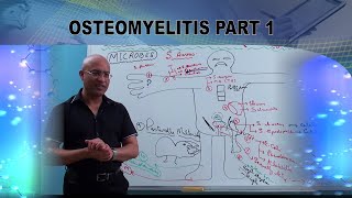 Osteomyelitis  Causes amp Symptoms  Bone Infection🩺 [upl. by Odin]