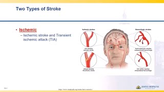 Ischemic heart disease [upl. by Alberto183]