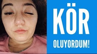 İpek Kirpik Faciası KÖR OLUYORDUM [upl. by Campbell479]