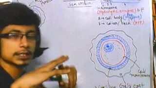 AgeRelated Macular Degeneration Exudative Fundoscopy [upl. by Anas]