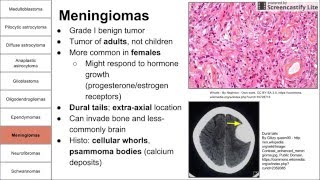 Nervous System Tumors [upl. by Akenahs]